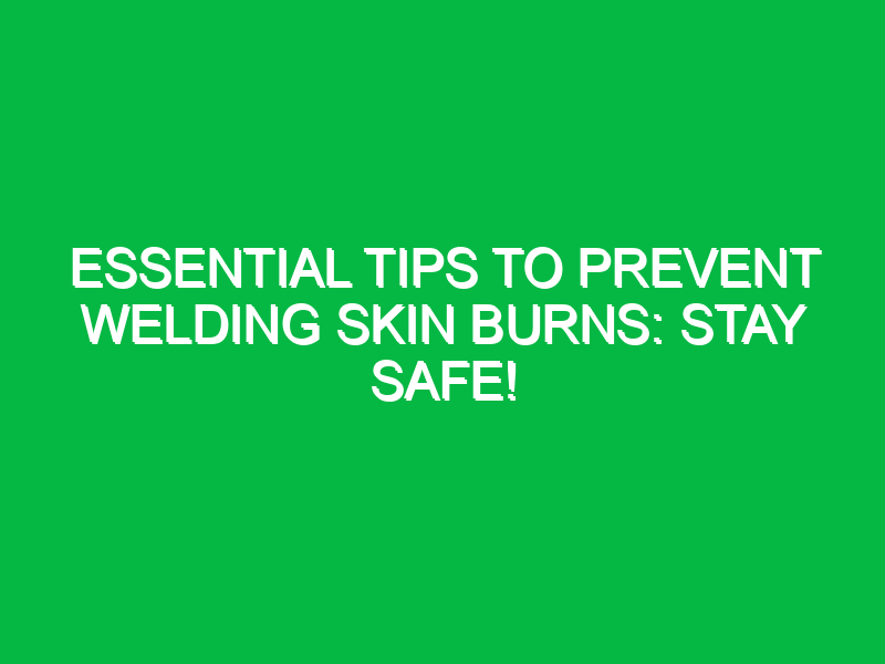 essential tips to prevent welding skin burns stay safe 15329