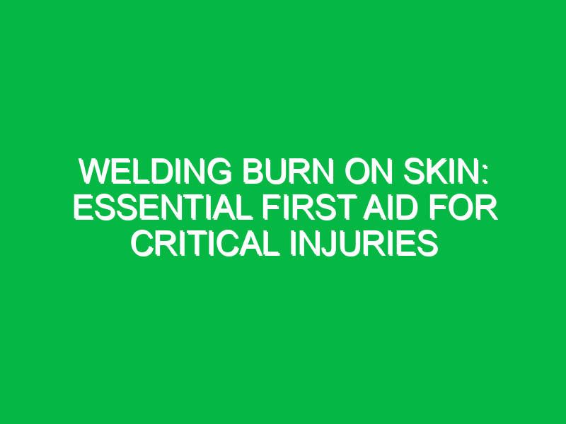 welding burn on skin essential first aid for critical injuries 16225